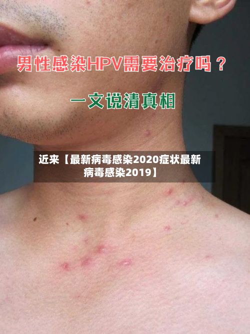 近来【最新病毒感染2020症状最新病毒感染2019】
