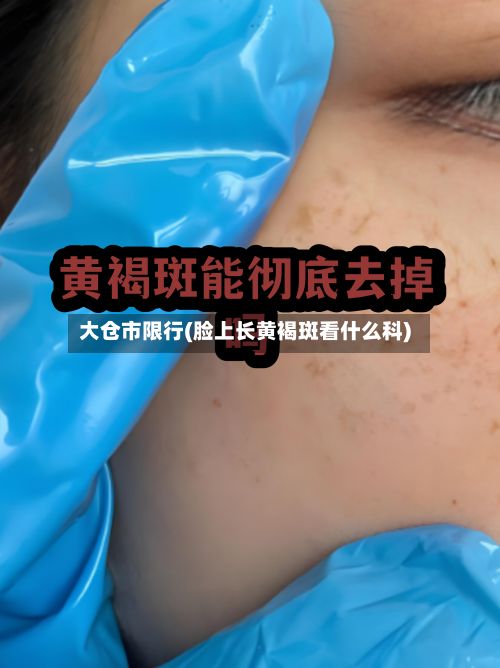 大仓市限行(脸上长黄褐斑看什么科)-第2张图片