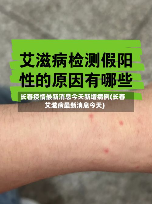 长春疫情最新消息今天新增病例(长春艾滋病最新消息今天)